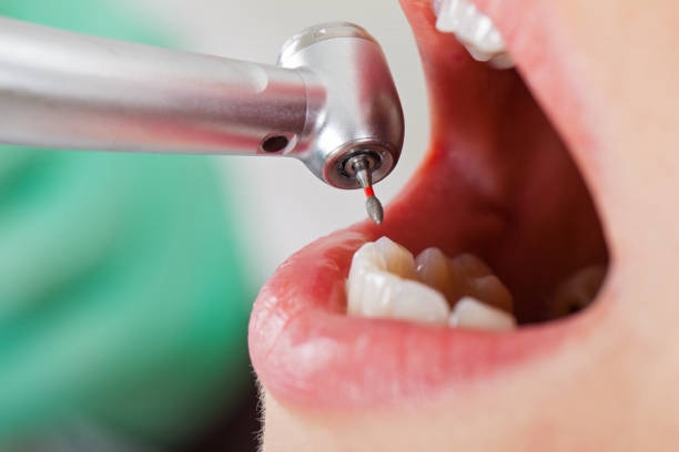 Best Emergency Broken Tooth Repair in Redan, GA